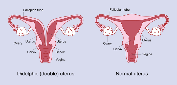 Didelphic uterus If your uterus is didelphic, it means that uterus womb is split in two.