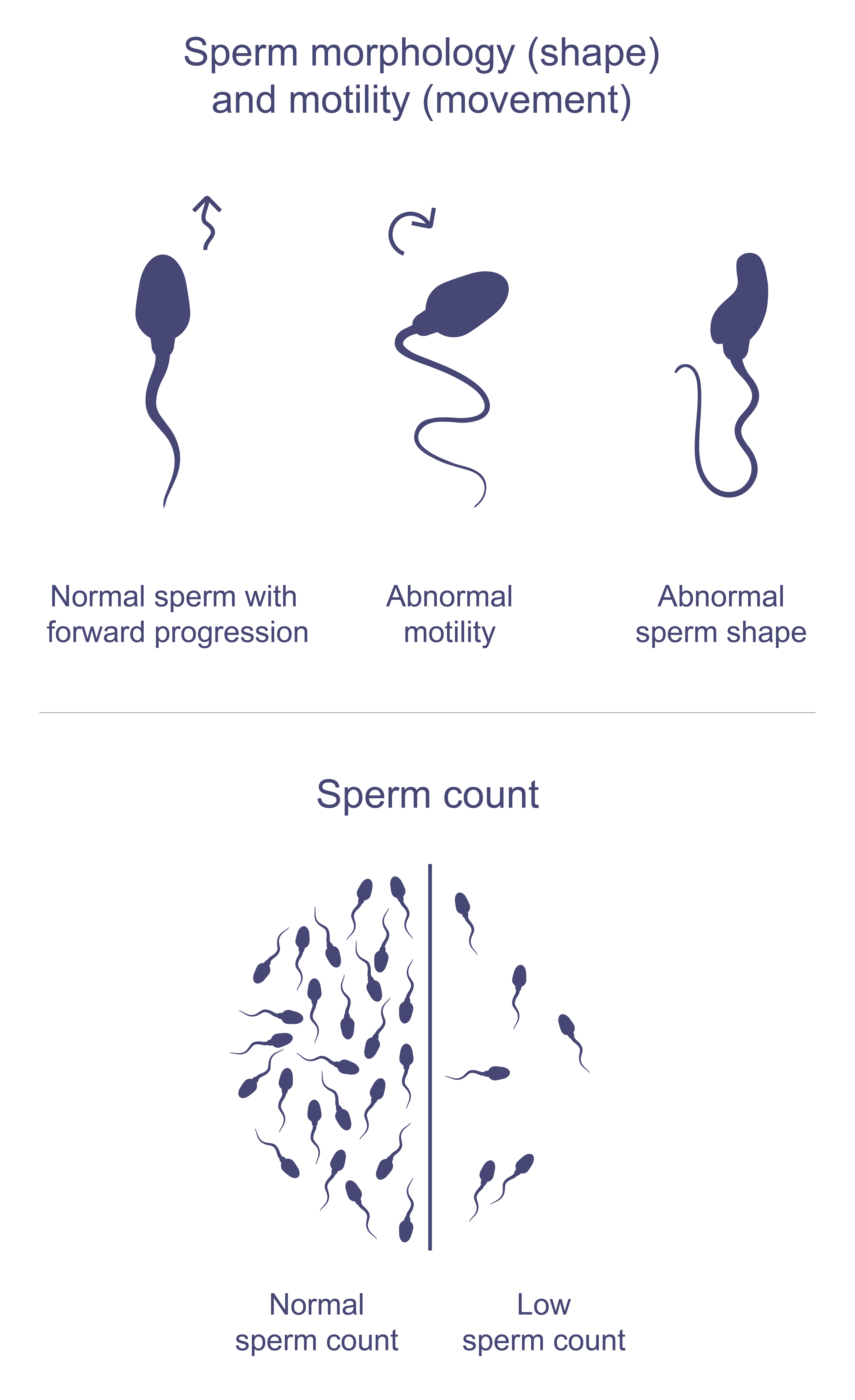 Sperm Health Infographic on sperm health, showing examples of normal sperm movement (forward spiraling like a cork screw) and abnormal movement (zig zagging or circling in on itself), normal sperm shape (oval head with a long tail) and an abnormal shape (head or tail defects). Along with a side by side comparison of normal sperm count (at least 15million sperm per mL) and low sperm count.